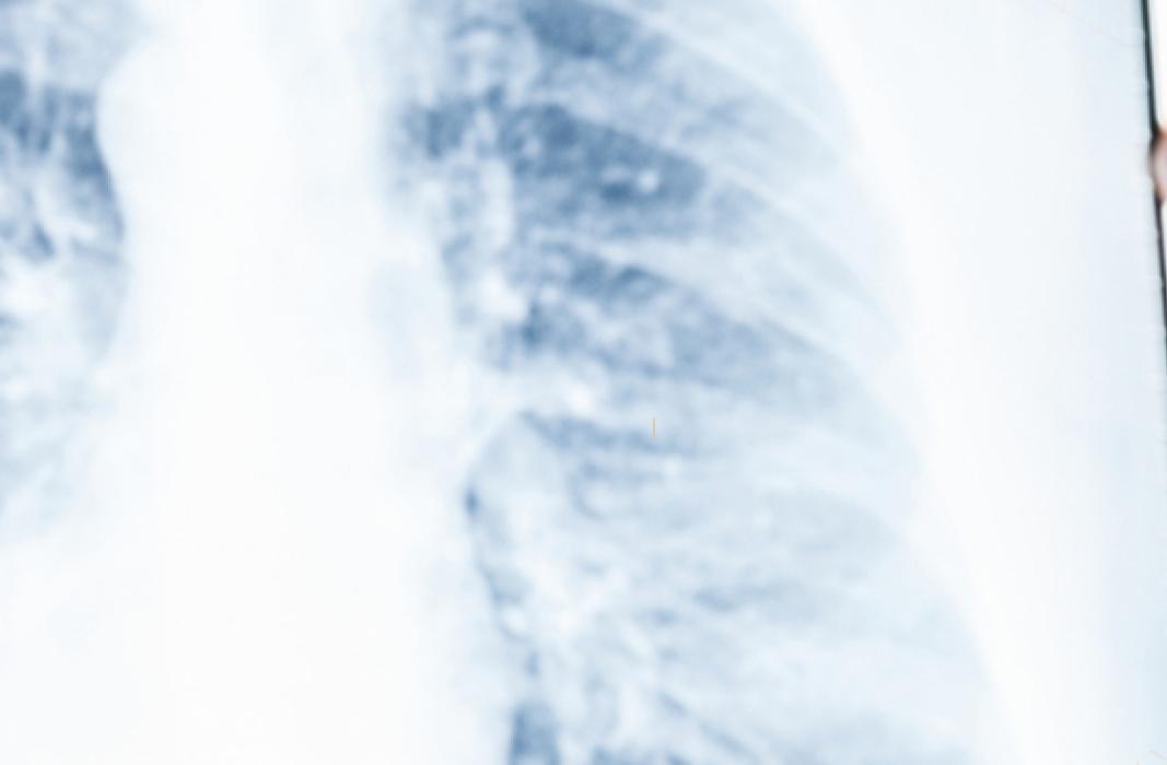 Saint-Gobain Medical Pneumologischer Markt