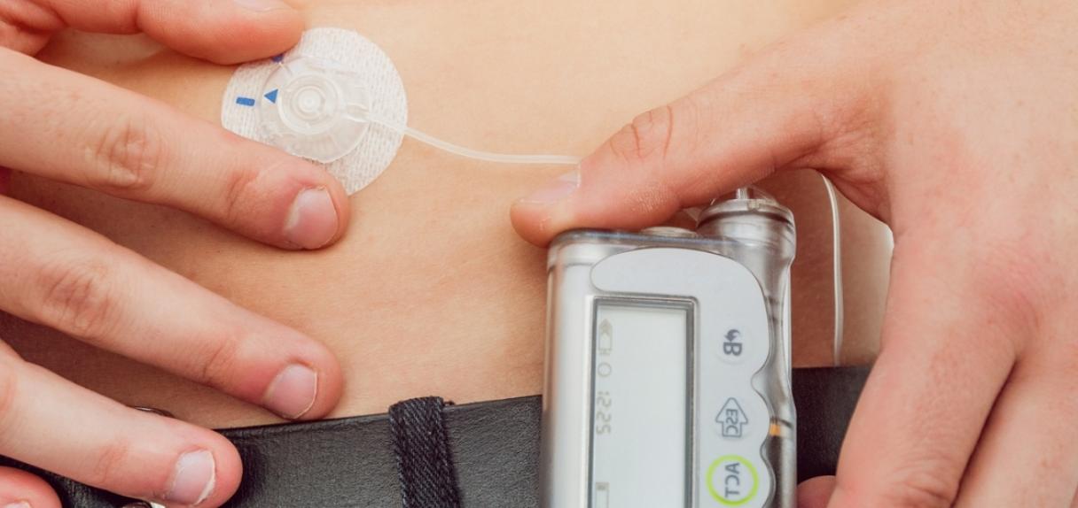 Person wearing glucose monitor