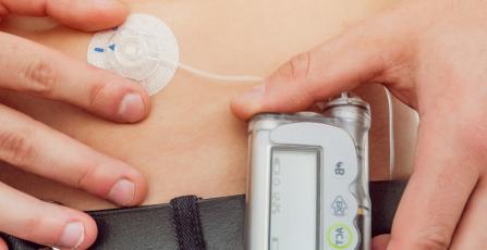 Person wearing glucose monitor
