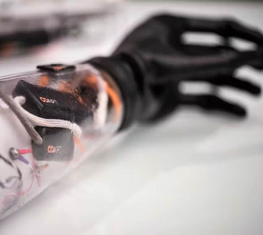 prosthetic arm