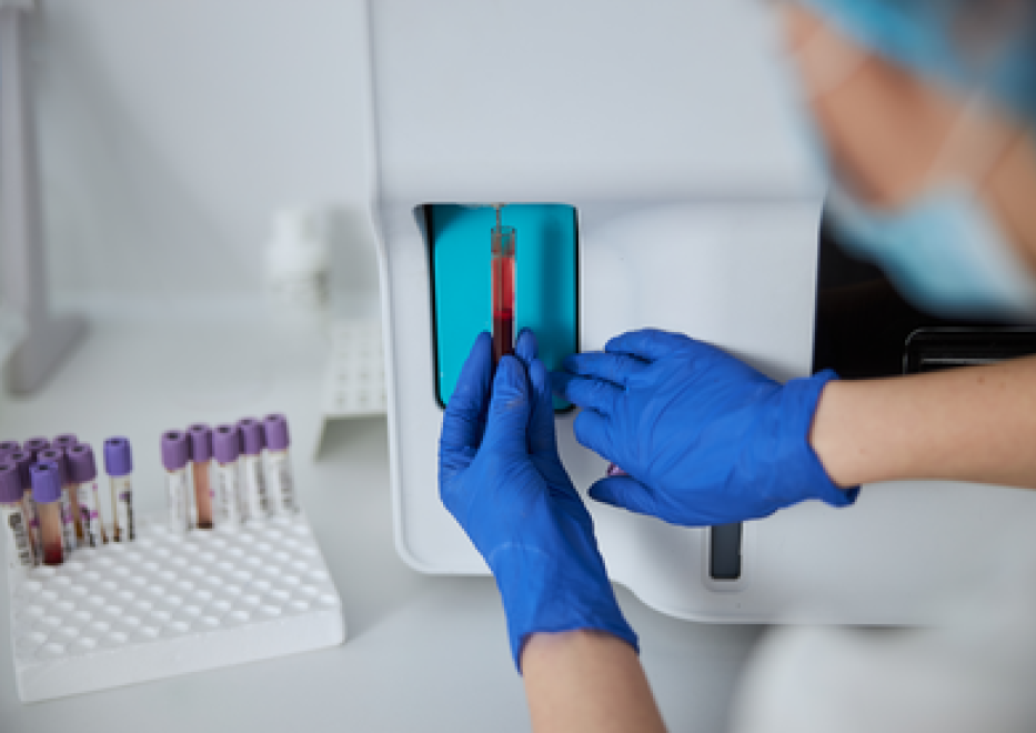 Adding Life Diagnostics In Vitro Diagnostics (IVD) Solutions | Saint-Gobain Medical